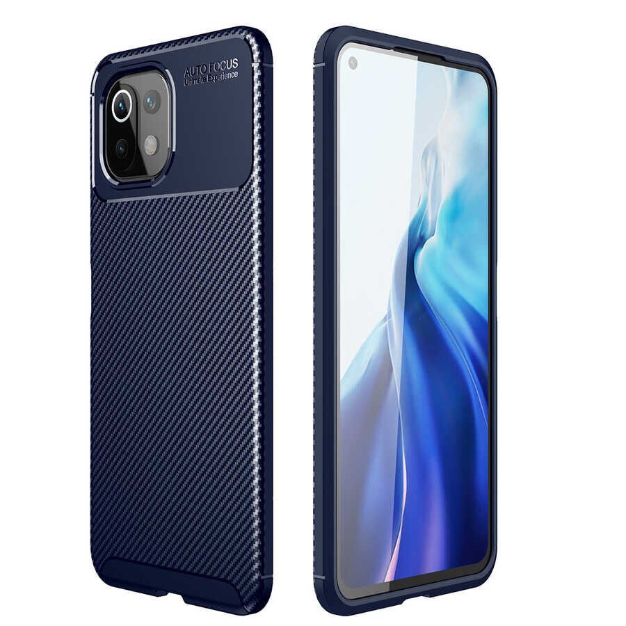 Xiaomi Mi 11 Lite Kılıf HEPTEKİLETİŞİM Negro Silikon Kapak