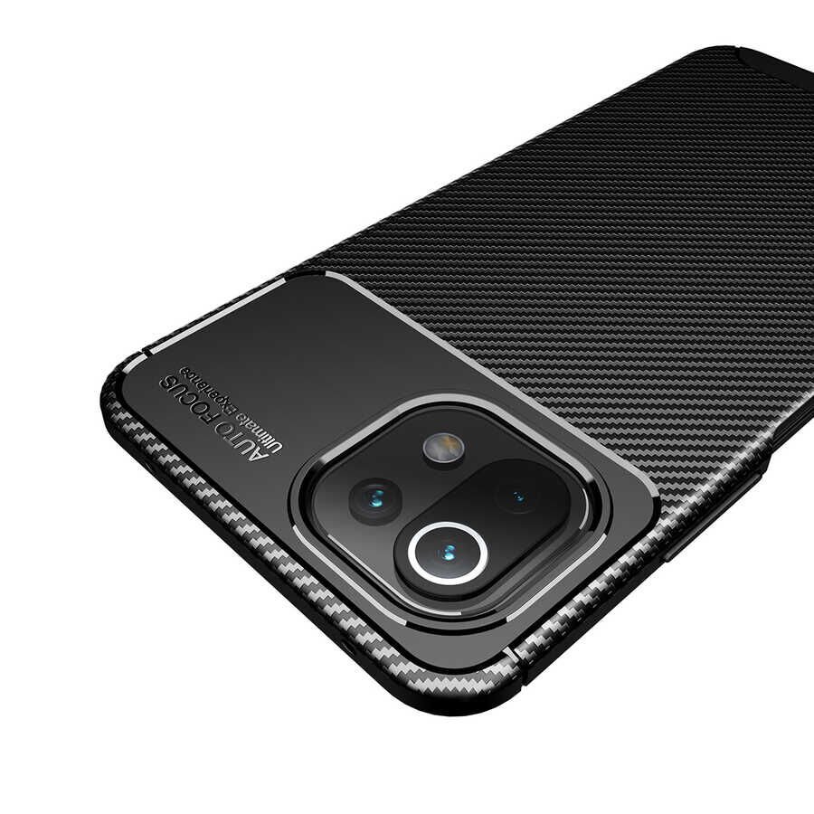 Xiaomi Mi 11 Lite Kılıf HEPTEKİLETİŞİM Negro Silikon Kapak