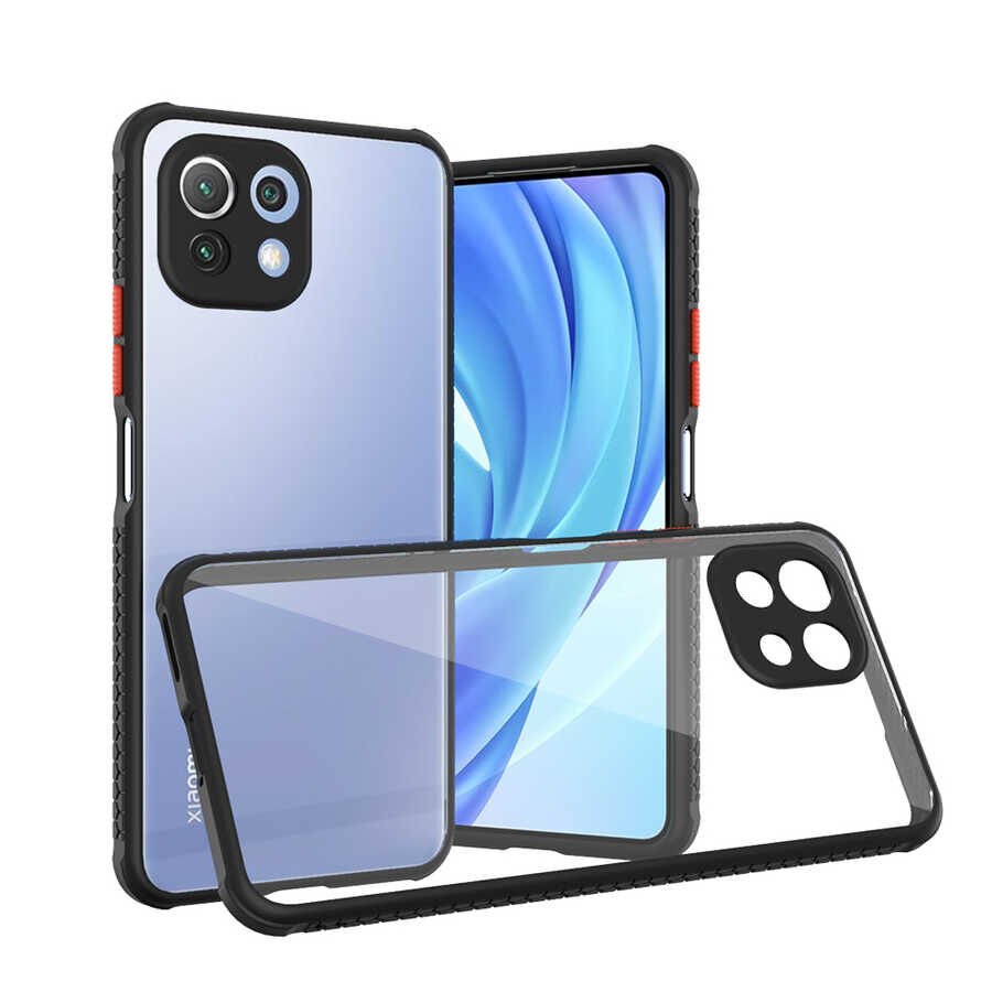 Xiaomi Mi 11 Lite Kılıf Köşe Ve Kamera Korumalı Arkası Şeffaf Renkli Tuşlu Kapak (KAFF) Siyah