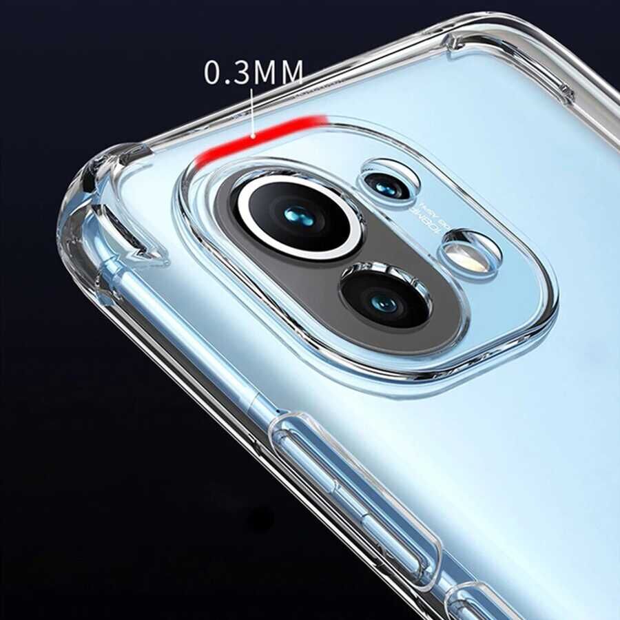 Xiaomi Mi 11 Lite Kılıf HEPTEKİLETİŞİM Kamera Korumalı Nitro Anti Shock Silikon