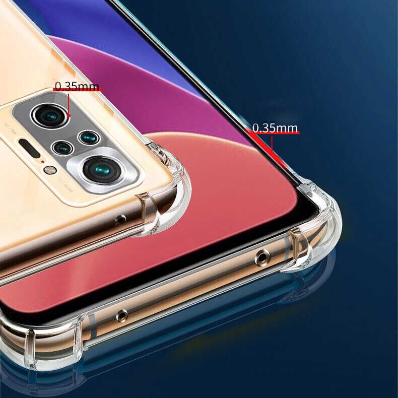 Xiaomi Redmi Note 10 Pro Kılıf HEPTEKİLETİŞİM Kamera Korumalı Nitro Anti Shock Silikon