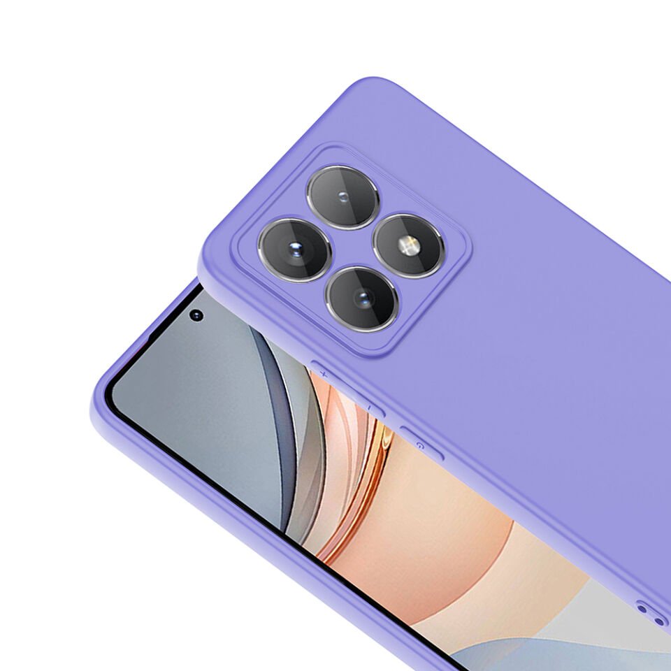 Xiaomi 14T Pro Kılıf HEPTEKİLETİŞİM Mara Lansman Kapak