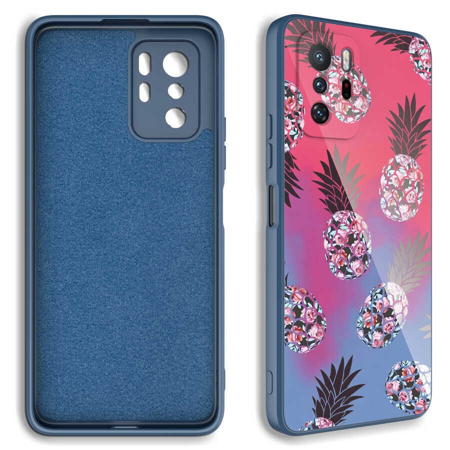 Xiaomi Redmi Note 10 Pro Kılıf Kamera Korumalı Desenli Sert Silikon HEPTEKİLETİŞİM Epoksi Kapak