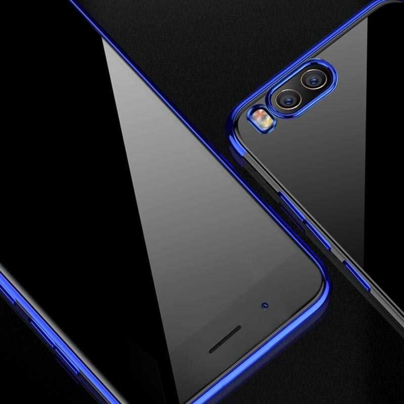 Xiaomi Mi 6 Kılıf Dört Köşe Renkli Lazer Şeffaf Silikon Kapak (GLİTTER) Gri