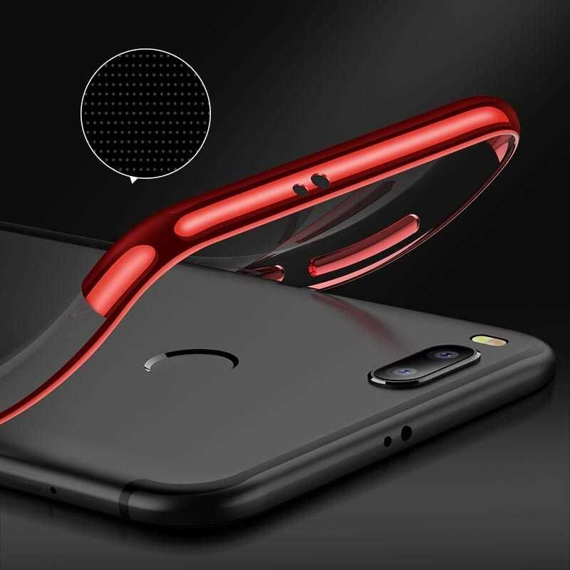 Xiaomi Mi 5x Kılıf Dört Köşe Renkli Lazer Şeffaf Silikon Kapak (GLİTTER) Gold