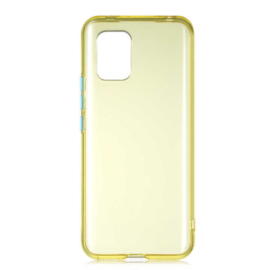 Xiaomi Mi 10 Lite Kılıf HEPTEKİLETİŞİM Bistro Kapak